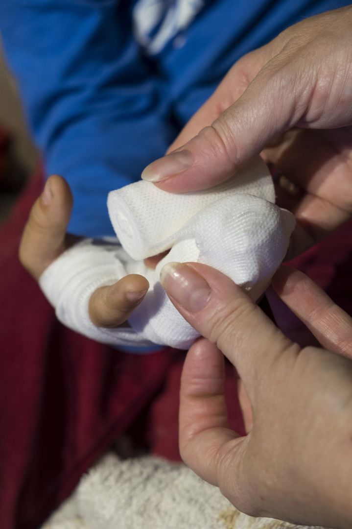 Calgary man uses his new first aid skills - on himself!