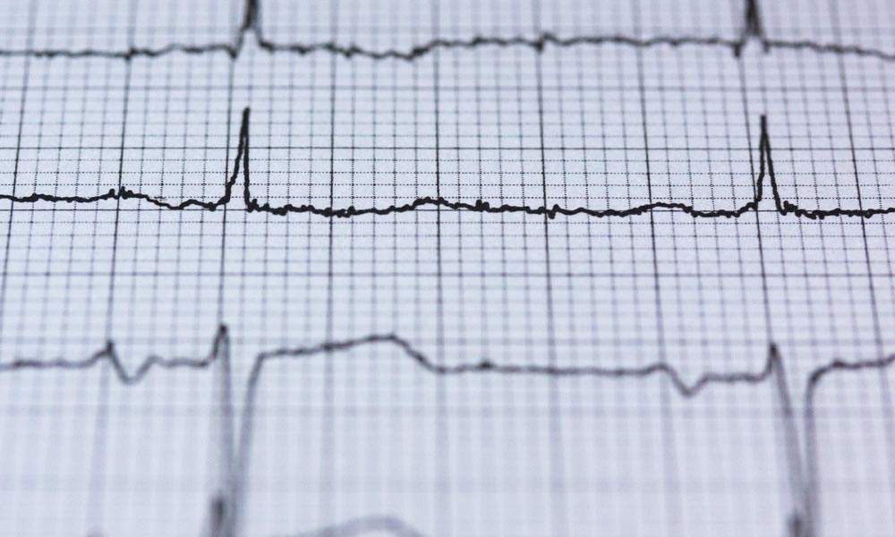 What to do if you think someone is having a heart attack